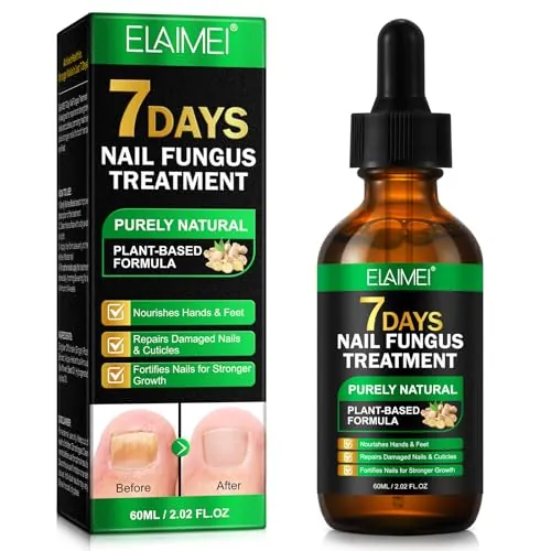 7 Days Nail Fungus Treatment, Ginger Nail Growth Serum Natural Nail Growth Serum con jengibre, jojoba y aceite de girasol | Restauración de uñas dañadas, cuidado antihongos para pies y uñas, 60 ml